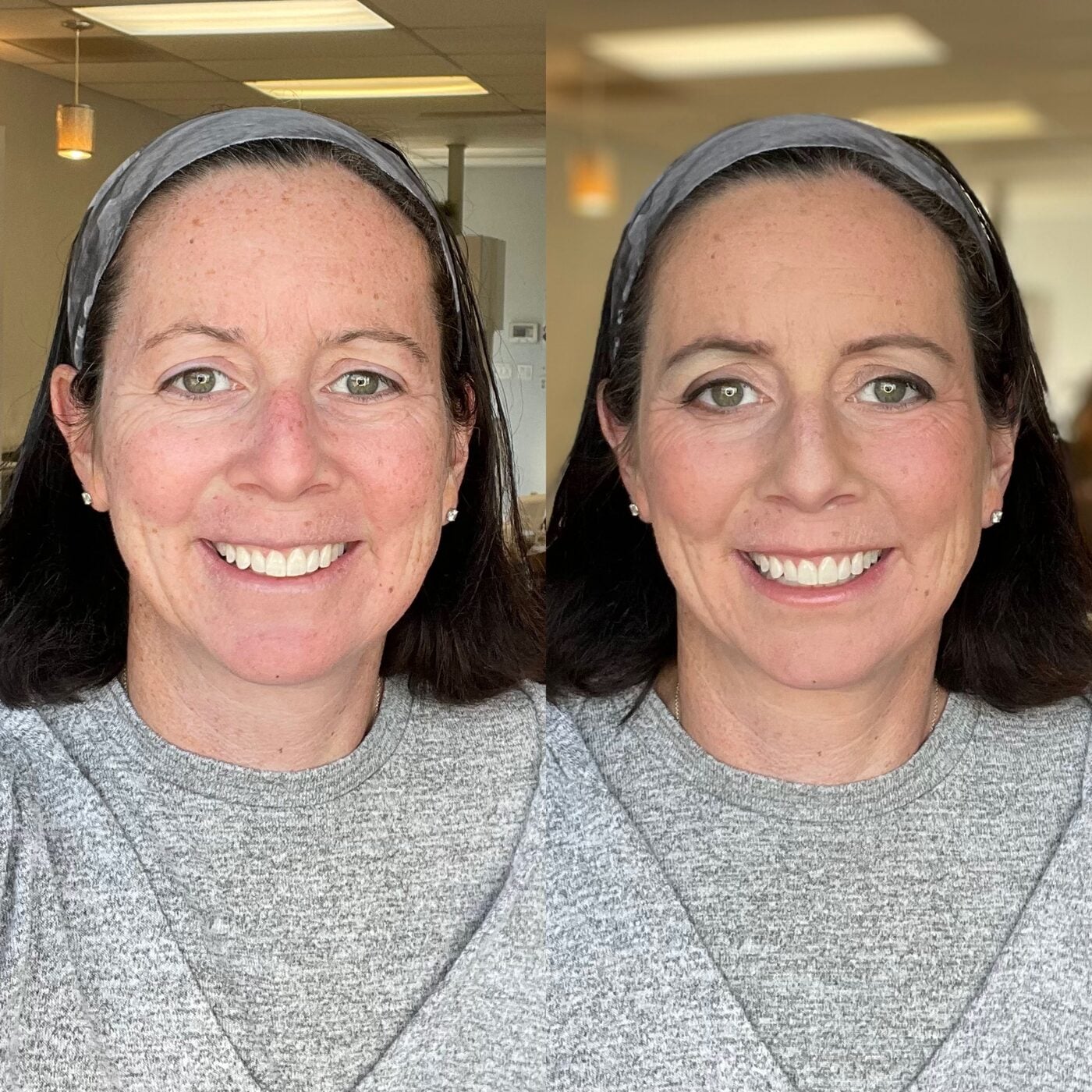 natural-facelift-ba-f Smiling woman with dark hair and a gray headband, before and after natural makeup